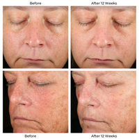 AGE-DEFYING AM/PM REGIMEN