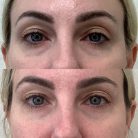 SKIN TIGHTENING PACKAGE