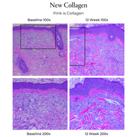 12 week clinical study of collagen production for Lift + Renew