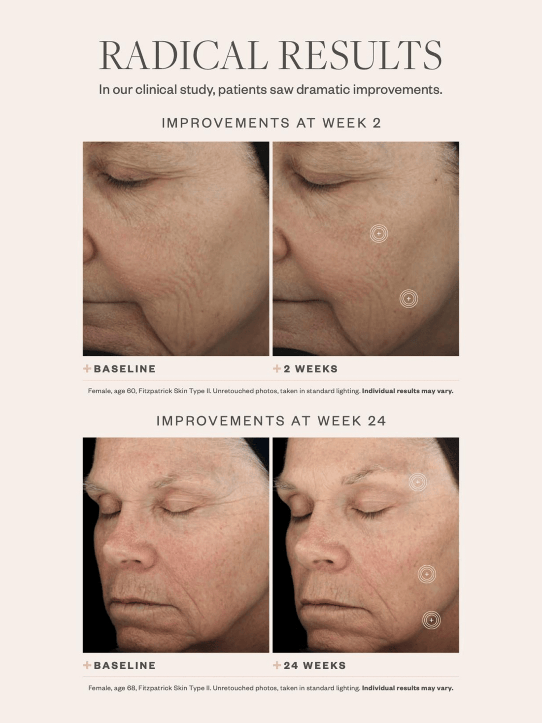 Woman Before and After Using Anti Aging Serum