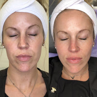 DIAMOND GLOW FACIAL PACKAGE