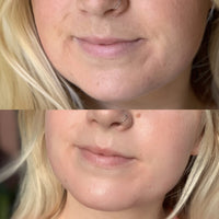 DIAMOND GLOW FACIAL PACKAGE