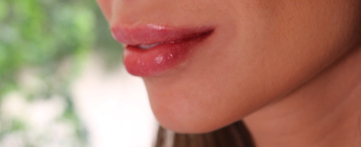 Everything You Need to Know About Lip Filler