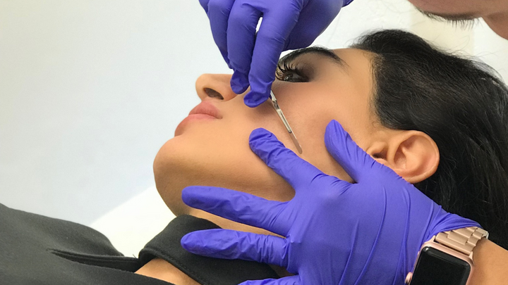 Ultimate Guide To Dermaplaning