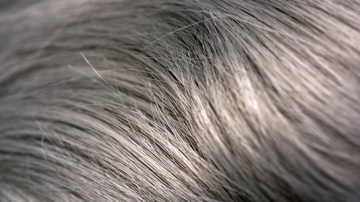 Why Does Hair Turn Gray?