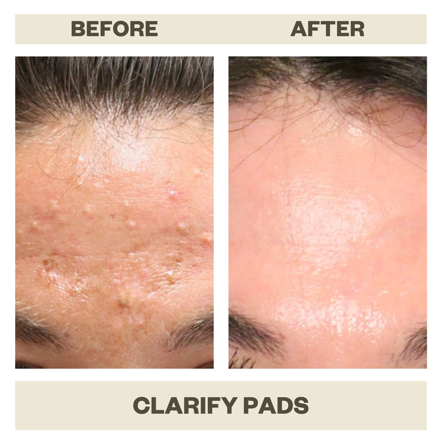 CLARIFY PADS