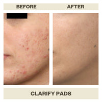 CLARIFY PADS