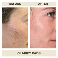 CLARIFY PADS