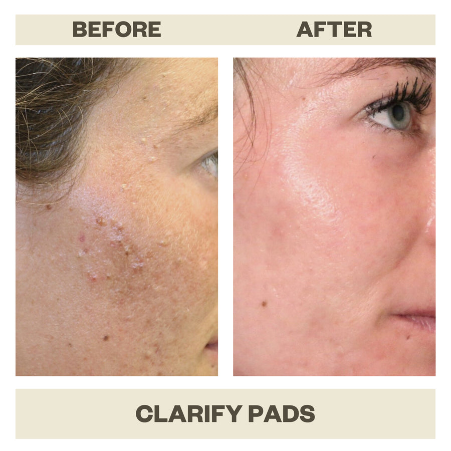 CLARIFY PADS