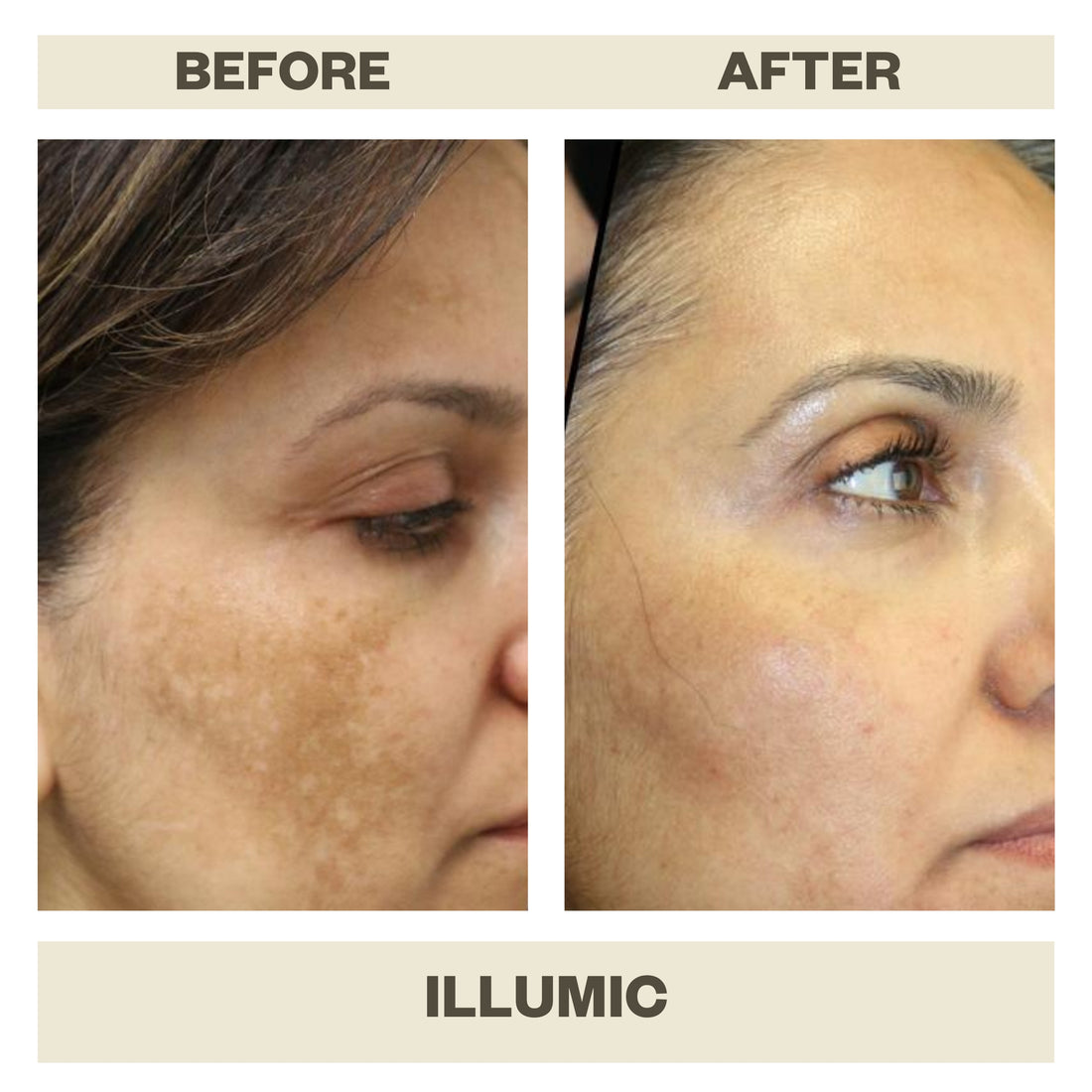 ILLUMIC WITH FERULIC ACID