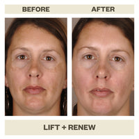 LIFT + RENEW SERUM