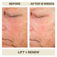 LIFT + RENEW SERUM