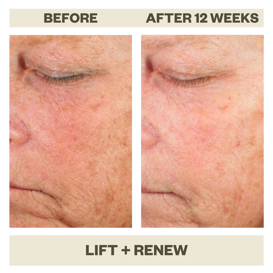 LIFT + RENEW SERUM