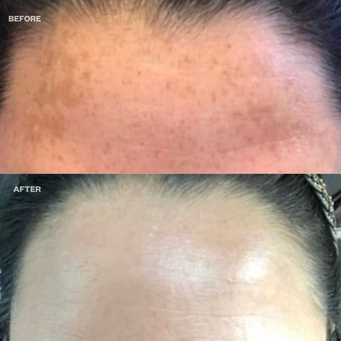 DERMABRIGHT