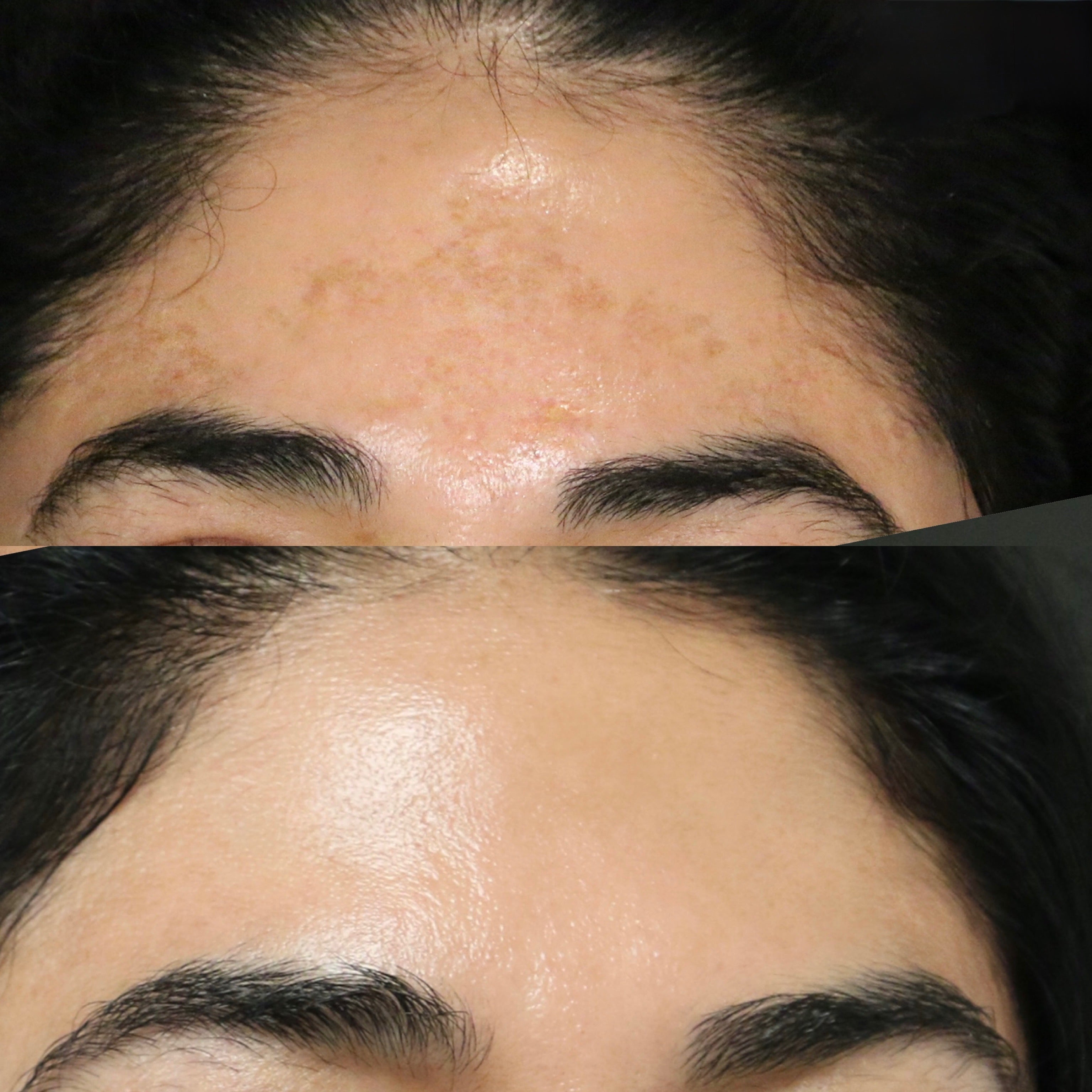 EltaMD UV Tinted Moisturizer with SPF – AziMD Skincare