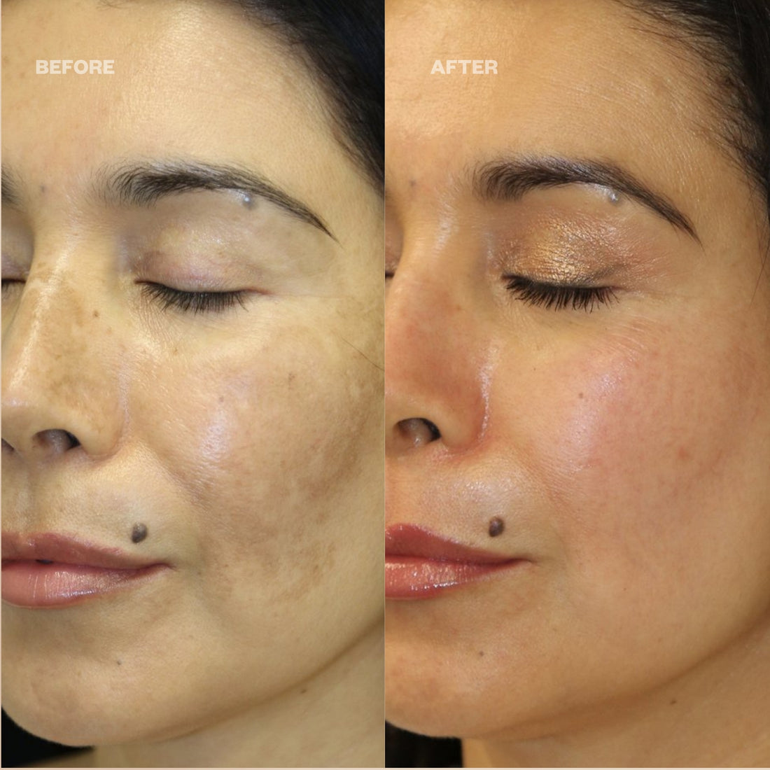 ILLUMIC WITH FERULIC ACID