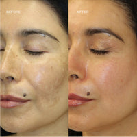 ILLUMIC WITH FERULIC ACID