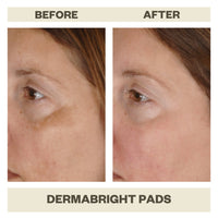 DERMABRIGHT