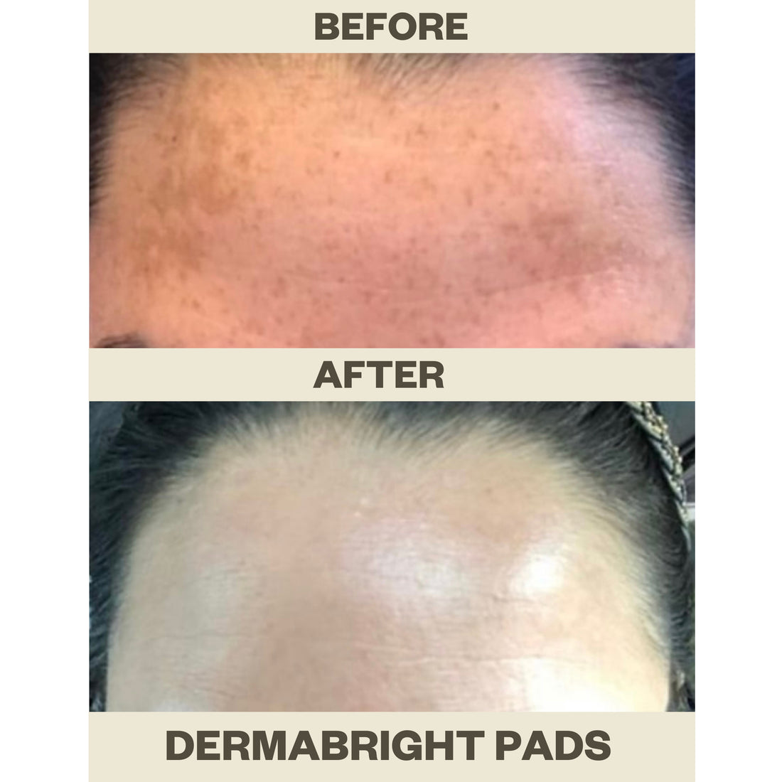 DERMABRIGHT