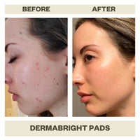 DERMABRIGHT