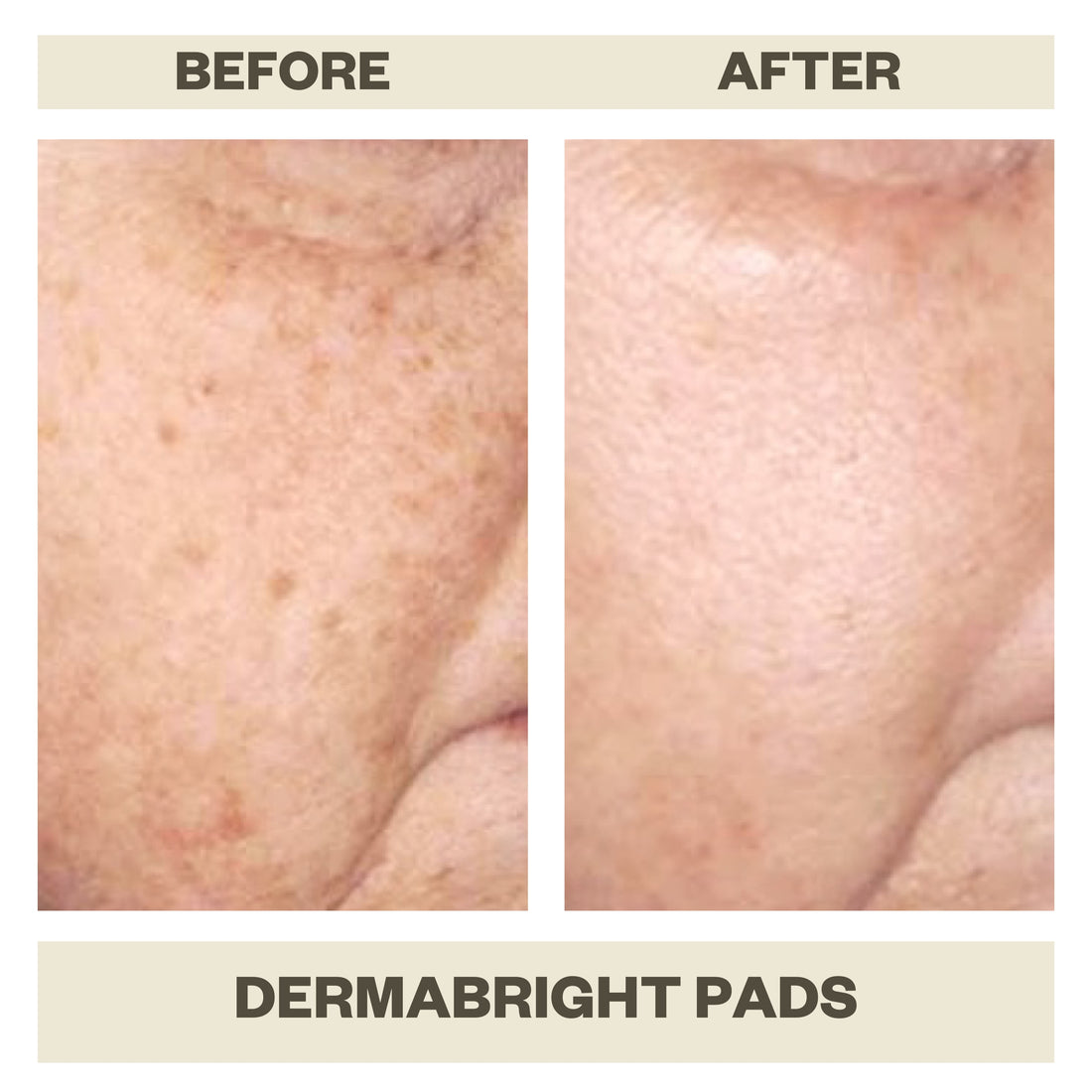 DERMABRIGHT