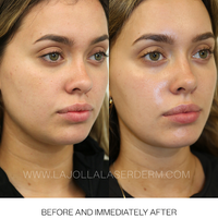 DIAMOND GLOW FACIAL PACKAGE