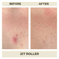 ZIT ROLLER