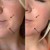 DIAMOND GLOW FACIAL PACKAGE